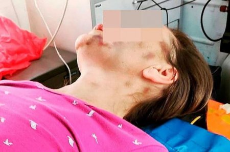 Boşanmaq istəyən arvadını evə bağlayıb, bir ay ac saxladı - FOTO