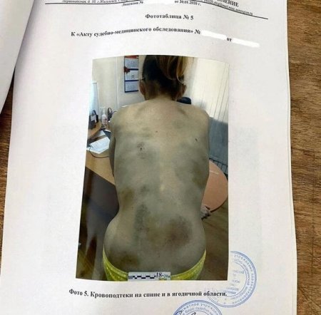 Boşanmaq istəyən arvadını evə bağlayıb, bir ay ac saxladı - FOTO