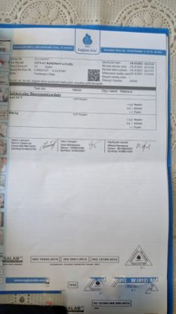 Elmi-Tədqiqat Hematologiya və Transfuziologiya Mərkəzində RƏZALƏT: olmayan virus belə “tapılıb”-FOTOFAKT