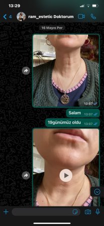 Pul, yoxsa insan həyatı? - Sual sizədir, cənablar ! // VİDEO + FOTO