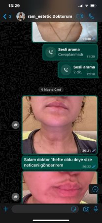 Pul, yoxsa insan həyatı? - Sual sizədir, cənablar ! // VİDEO + FOTO