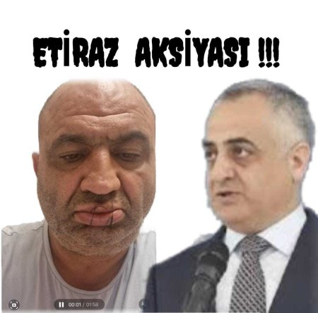Qazinin ağzını tikməsinə səbəb olan məmurlar... - VİDEO