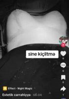 Dr.Ella necə estetik əməliyyatlar icra edir? -Araşdırma