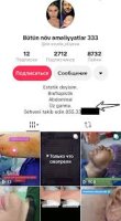 Elmina Həsənova pasiyent ovunda: Saxta  ”Dr.SevdaEliyeva” qanunsuz estetik əməliyyatlar icra edir?  -  Fotofakt